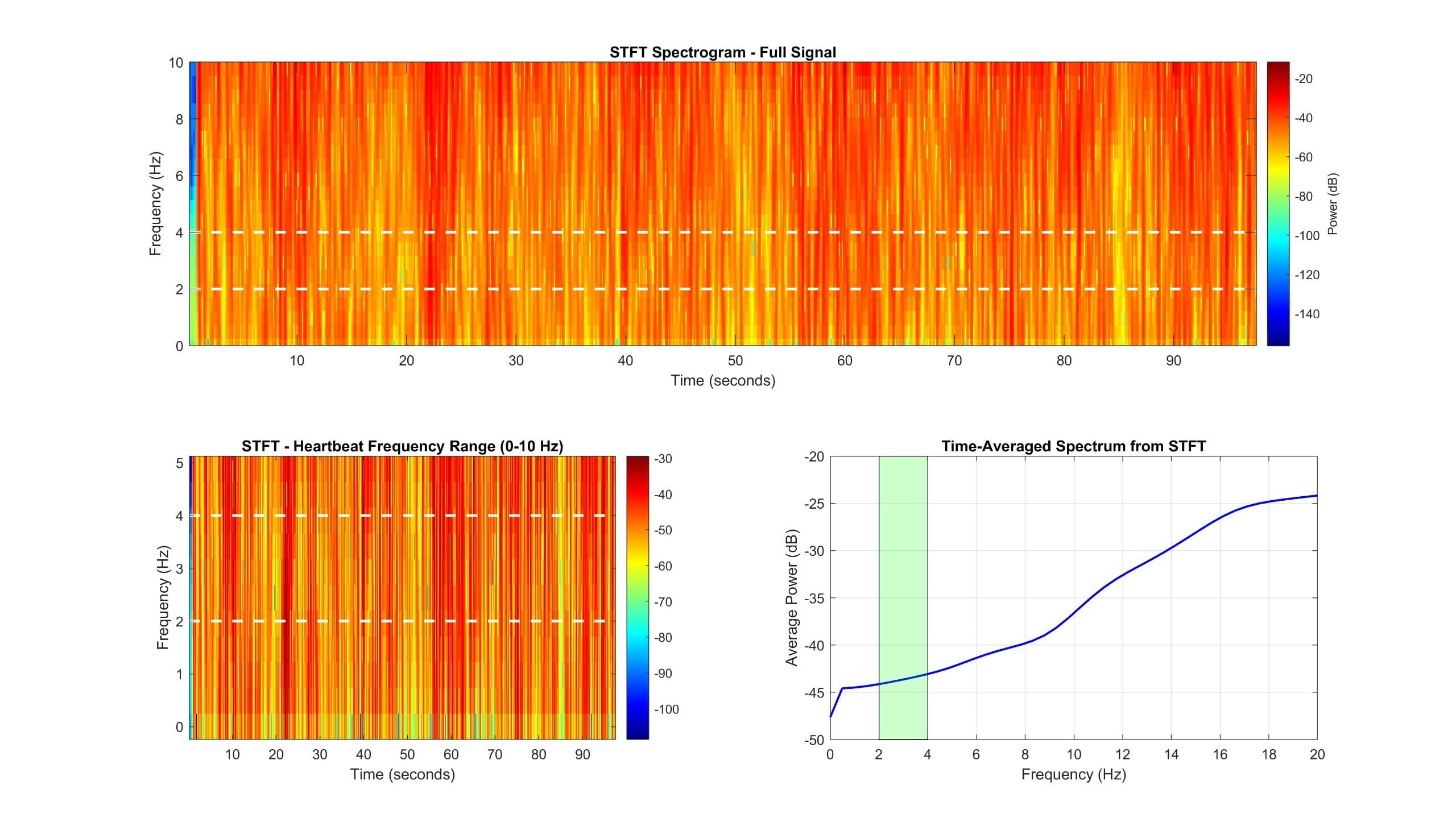 Audio Analysis Image project image 1