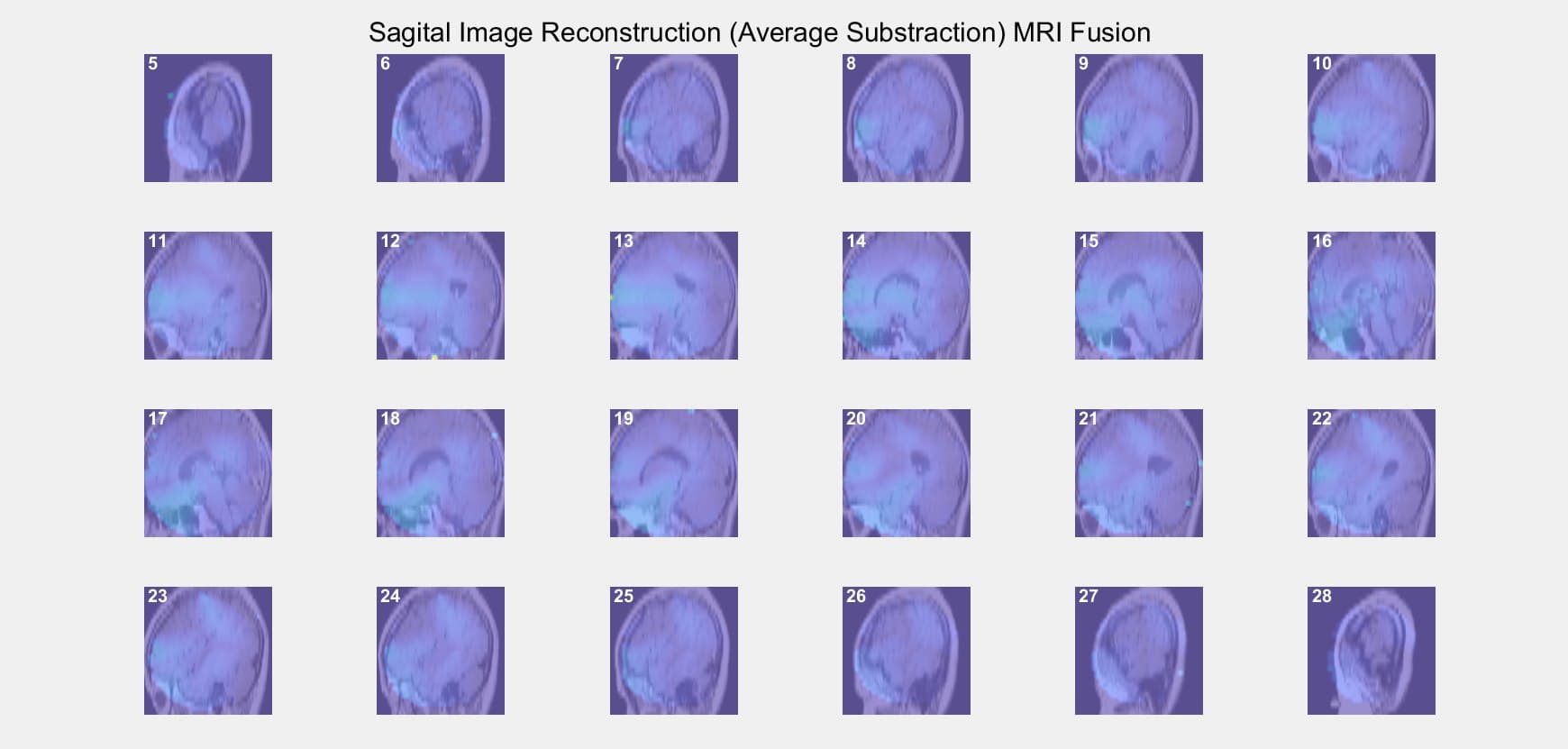 2D to 3D ECVT Reconstruction project image 1
