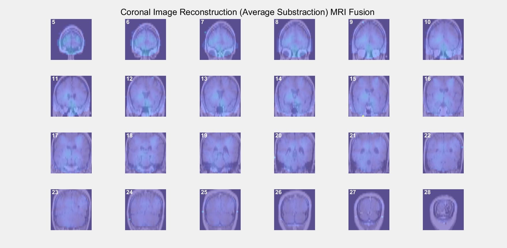 2D to 3D ECVT Reconstruction project image 2