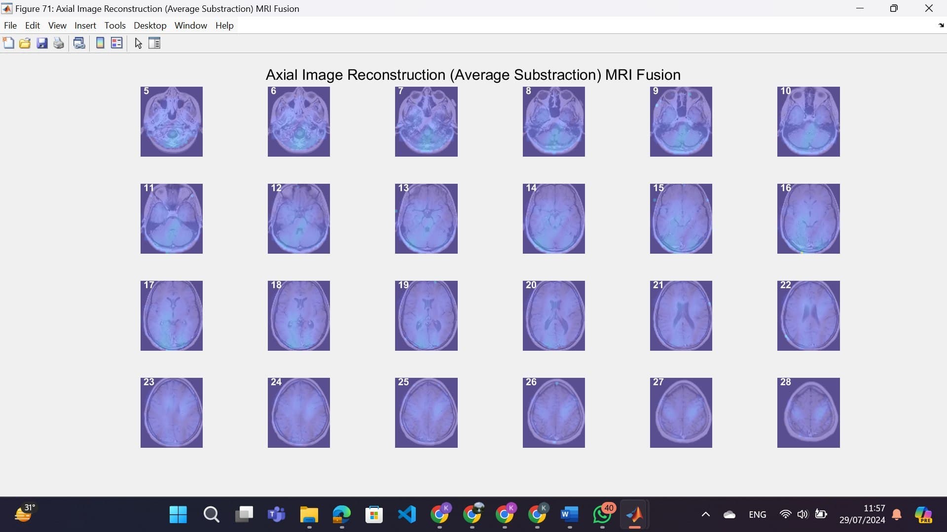 2D to 3D ECVT Reconstruction project image 3