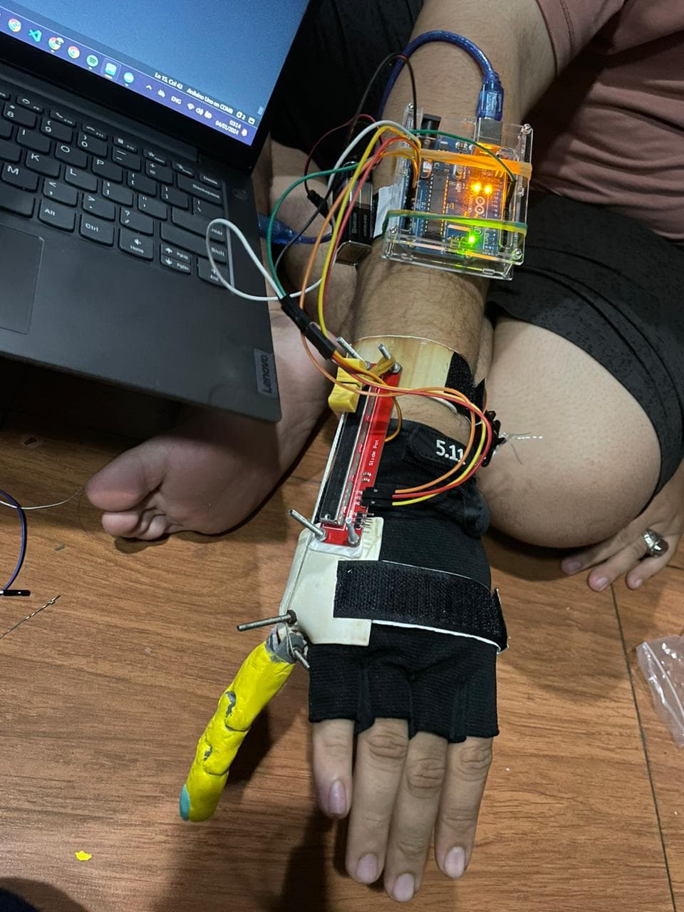 Prosthetic Project Image project image 1